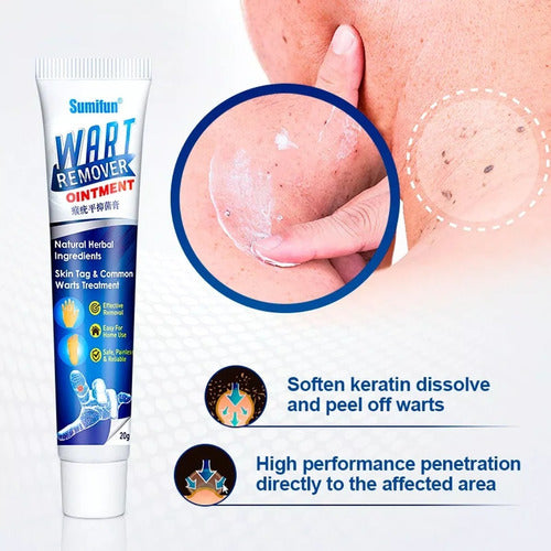 Wart Treatment Cream Callus Remover Imported 4