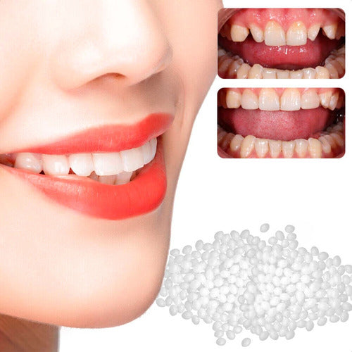 MAGIC TEETH Pack of 10 Moldable Temporary Dentures 0