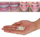 EASY TOOCH: Temporary Tooth Replacement Kit 4