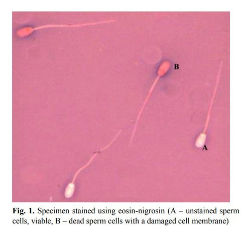 Salttech Eosine Staining Kit - Nigrosine X 30 Ml 3