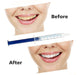 Blanqueador Dental Whitening Oral Gel 44% Peroxido Premium 3