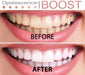 Opalescence Boost 40% Whitening Gel with Gingival Barrier 2