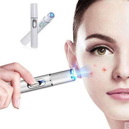 DD2 Laser Machine for Removing Tattoos, Acne, and Skin Blemishes - UV Light Skin Repair 0