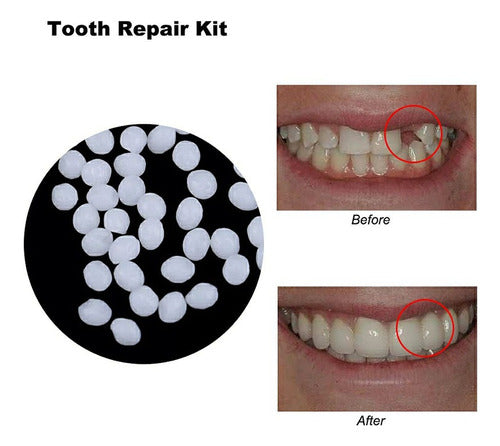 EASY TOOCH: Temporary Tooth Replacement Kit 2