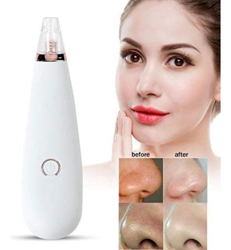 Limpiador Extractor Facial Poros Removedor Puntos Negros 2