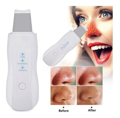 Espátula Facial Recargable Ultrasónica Scrubber Peeling Skin 1