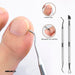 Kit of 15 Pieces for Foot Care with Callus Clippers and Foot Files 5