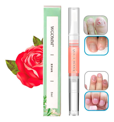 Hongos Nail Repair Serum for Fungal Infection Treatment for Hands and Feet 0