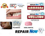 Repair Now Provisional Dental Prosthesis Kit 1