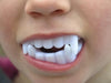 Dientes De Dracula Vampiro Blancos Halloween X 12 Unidades 2