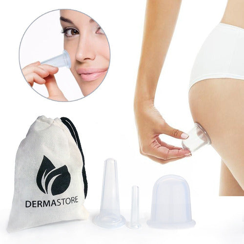 Dermastore 2 Chinese Facial Cups and 1 Medium Anti-Cellulite Cup 0