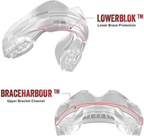 Safejawz Mouthguard For Braces, One Size Re-mouldable Mouth 1