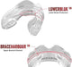 Safejawz Mouthguard For Braces, One Size Re-mouldable Mouth 1