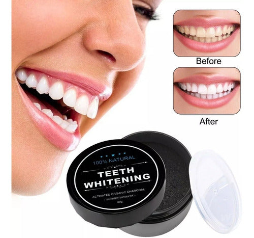 Miracle Teeth Whitening Natural Coconut Activated Charcoal Teeth Whitener 0