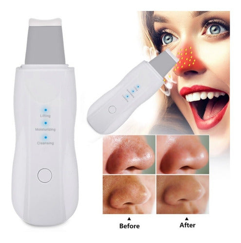 Rechargeable Ultrasonic Facial Spatula Skin Scrubber 0