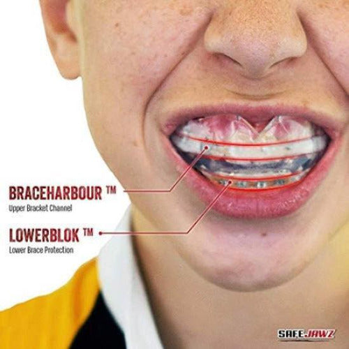 Safejawz Mouthguard For Braces, One Size Re-mouldable Mouth 6