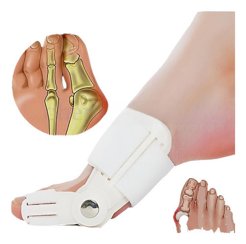 1pcs Valgus Dedo Juanete Plancha Férula Corrector Dolor Rele 0