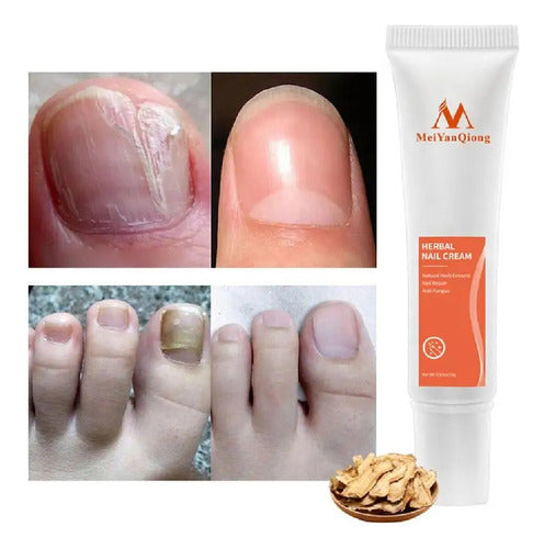 Bioaqua Herbal Foot Repair Cream for Fungal Infections and Onychomycosis 1