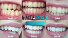 2 Clareador Dental Whitemax Valor 2019 Anvisa 3