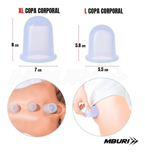 Mburi Sport Set Corporal De Ventosas Chinas De Silicona Anti Celulitis 1