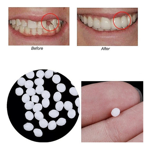 Moldeable Dental Temporary Filling Repair 2