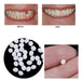 Moldeable Dental Temporary Filling Repair 2