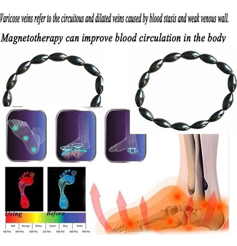 Magnetic Ankle Bracelet for Varicose Veins and Cellulite Treatment 6