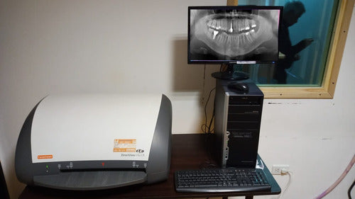 Carestream Digital Dental Panoramic Digitizer 0