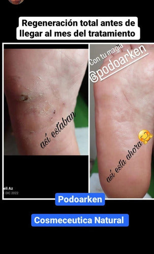 Podoarken Crema Regeneradora Linea Premium Podologia / Pedicuria 1