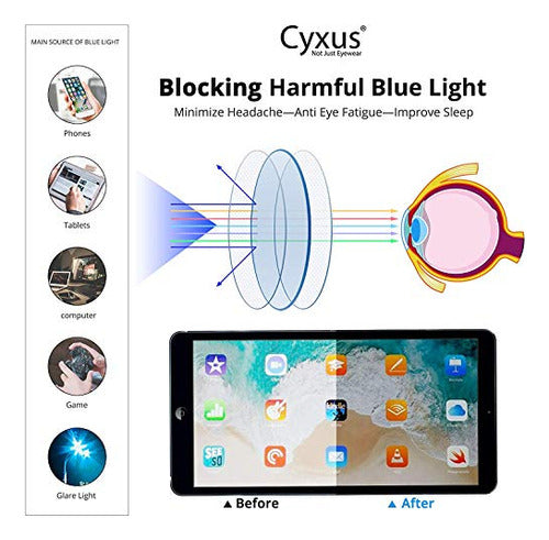 Cyxus - Gafas De Luz Azul Con Clip, Lentes Para Juegos De Or 1