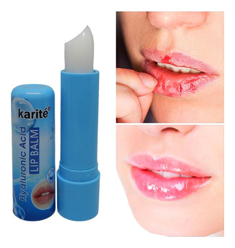 Karite Balsamo Labial Lip Balm Con Acido Hialuronico 0