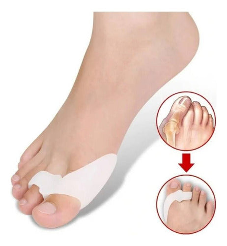 CIMARRON El Par Corrector De Juanetes Silicona Hallux Valgus 1