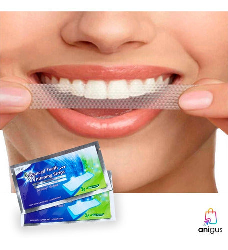 Advance Teeth Whitening Strips - Teeth Whitening Gel Bands x 28 Units 2