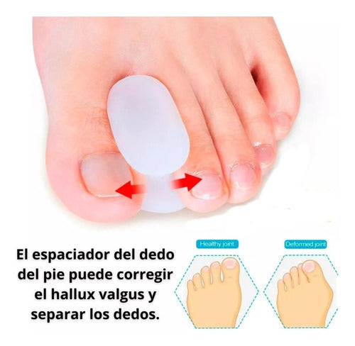 Pirotech Silicone Toe Separator Bunion Correctors 1