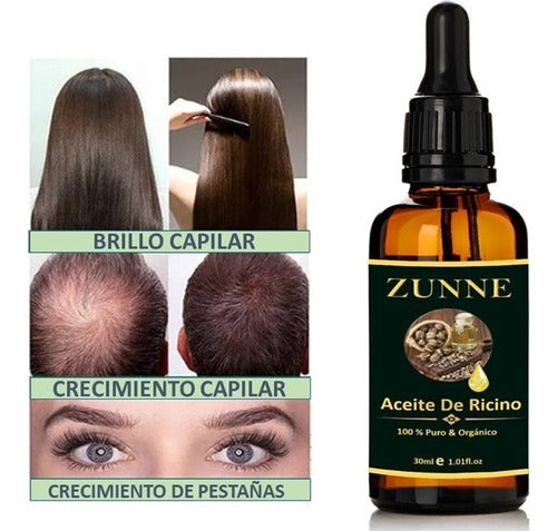 Zunne 100% Pure & Organic Cold-Pressed Castor Oil 0