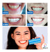 Advance Teeth Whitening Strips - Teeth Whitening Gel Bands x 28 Units 1