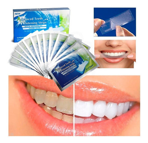 Advance Teeth Whitening Strips 28 Units Teeth Whitening Gel Bands 0