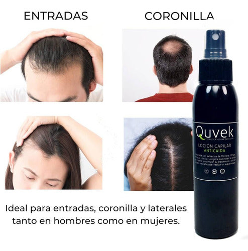 Quvek Anti-Hair Loss Growth Lotion 100 ml 2