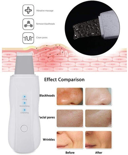 GLNS Ultrasonic Spatula Kit + Blackhead Remover + Nano Spray 5