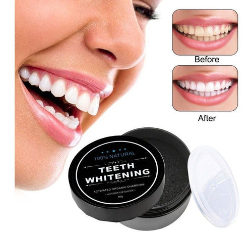 Miracle Teeth Whitening Natural Dental Bleach Carbon Coco Non-Damaging 3