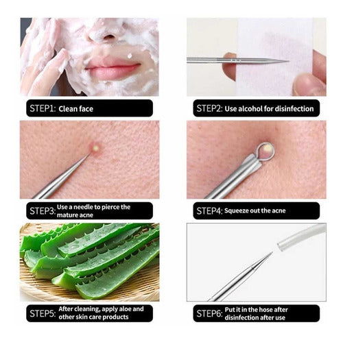 JM-once Blackhead and Acne Extractor Removal Tool Set 7