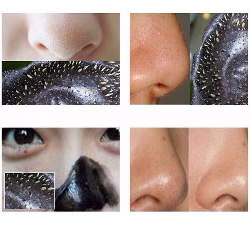 Blackhead Remover Pilaten Face Mask - Acne Cleansing Mask $ - Mascara Pilaten Limpiador Facial Antiacne Punto Negro $