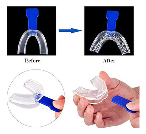 Moldeira Silicone Tratamento Do Ronco Apneia Do Sono 4