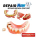 Repair Now Professional Denture Repair Kit 4