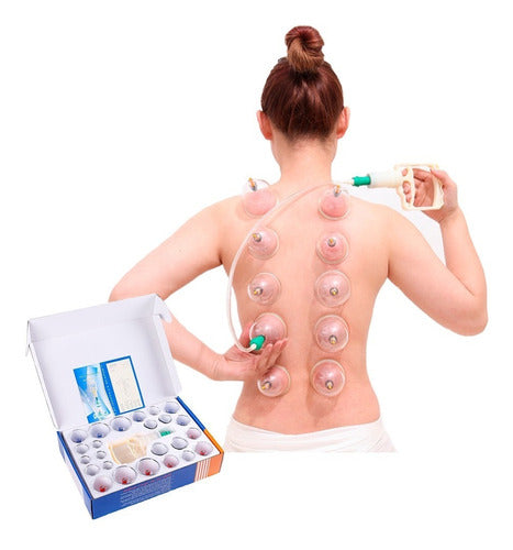 Set of 24 Chinese Cupping Therapy Cups Plastic Kit for Massages 1