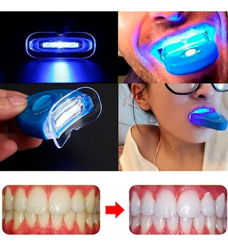 White Light Blanqueador Dental Electrónico UV + Gel + Placa Termoformable 5