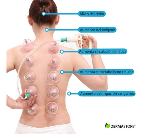 Body Massage 12 Fixed Chinese Cupping Suction Cups Set 2