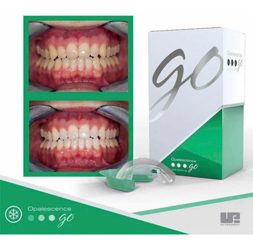 Opalescence Go 20 Cubetas / Blanqueamiento Dental 3