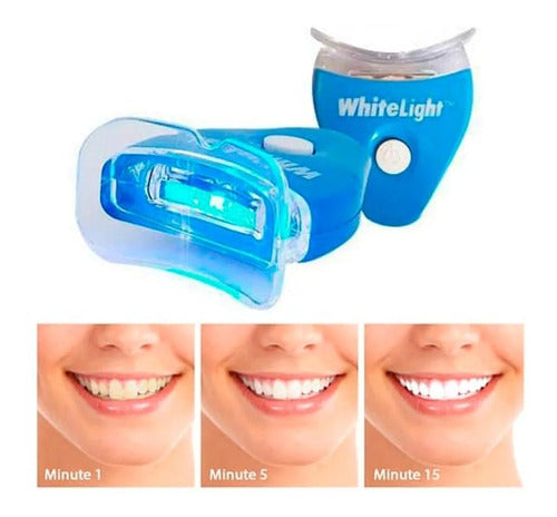 Blanqueador Dental Blanqueamiento Dientes Mas Blancos 3