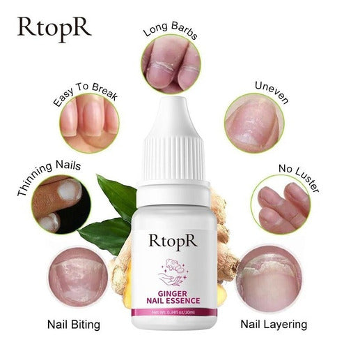 RtopR Nail Repair Cream with Ginger for Fungal Infections! 1